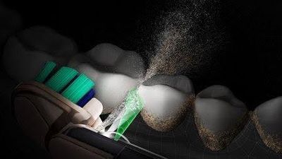 CameraJet™ Sees, Thinks and Jets—While You Brush